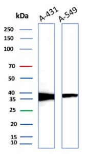RAD51 Antibody A431 and A549 WB. Western blot analysis of RAD51 expression using RAD51 antibody (clone RAD51/2701). Lane 1: human A431 cell lysate. Lane 2: human A549 cell lysate. RAD51, also known as RAD51 Recombinase, is a central mediator of homologous recombination and DNA double strand break repair that preserves genomic stability. A prominent band is detected at approximately 37 kDa in both cell lines, consistent with the expected molecular weight of RAD51. These results demonstrate endogenous expression of RAD51 in epithelial cancer cells and support the utility of this antibody for studies of DNA repair pathways, genome maintenance, and cellular responses to genotoxic stress.