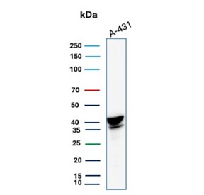 Western blot testing of human A431 cell lysate with SERPINB3 antibody. Predicted molecular weight ~46/39 kDa (two isoforms).