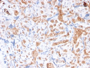 IHC staining of FFPE human placenta with Spectrin alpha 1 antibody (clone rSPTA1/1832). Required HIER: boil tissue sections in pH 9 10mM Tris with 1mM EDTA for 10-20 min followed by cooling at RT for 20 min.