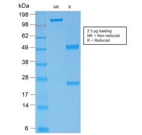 SDS-PAGE analysis of purified, BSA-free Spectrin alpha 1 antibody (clone rSPTA1/1832) as confirmation of integrity and purity.