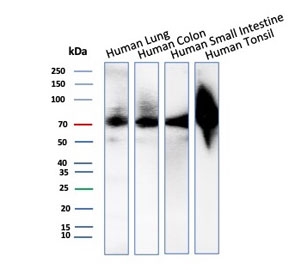 CD44 Antibody Human Tissue Glycoprotein WB. Western blot analysis of CD44 / CD44 antigen expression in human lung, colon, small intestine, and tonsil lysates using recombinant rabbit monoclonal antibody clone HCAM/2875R. Bands are observed across a range of approximately 75-110 kDa, consistent with glycosylation-dependent variation in CD44 molecular weight across different tissue types.