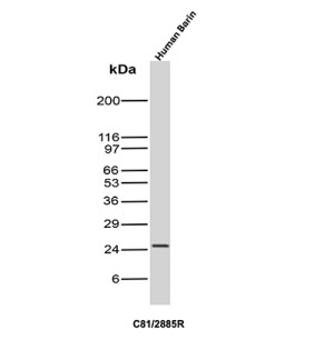 CD81 Antibody C81/2885R Human Brain WB. Western blot analysis of human brain tissue lysate using recombinant rabbit monoclonal CD81 Antibody, clone C81/2885R. A specific band is detected at approximately 24-25 kDa, consistent with the expected molecular weight of CD81. This recombinant CD81 Antibody detects CD81 in human brain tissue and supports studies of tetraspanin expression, membrane organization and cell signaling.