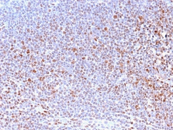 Recombinant Nuclear Marker Antibody Tonsil IHC. Immunohistochemistry staining of FFPE human tonsil tissue using Nuclear Marker Antibody (clone NM2984R) demonstrates distinct nuclear HRP-DAB brown staining throughout lymphoid cell populations. The staining pattern is consistent with recognition of a nuclear-associated antigen and provides clear visualization of cellular nuclei within the densely packed tonsillar architecture. Strong nuclear localization highlights individual lymphocytes and other resident immune cells while maintaining low background staining in non-nuclear compartments. The observed immunoreactivity supports the use of clone NM2984R for nuclear visualization, assessment of tissue organization, and studies requiring identification of cellular nuclei in normal and pathological specimens. HIER: boil tissue sections in pH 6 citrate buffer (10 mM) for 10-20 minutes and allow to cool prior to testing.