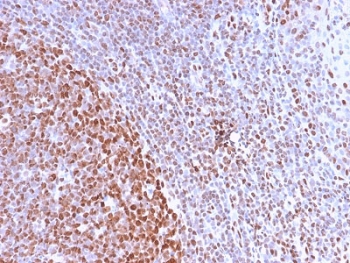 Recombinant Nuclear Marker Antibody Tonsil Germinal Center IHC. Immunohistochemistry staining of FFPE human tonsil tissue using Nuclear Marker Antibody (clone NM2984R) demonstrates strong nuclear HRP-DAB brown staining throughout lymphoid cell populations, with particularly intense labeling within germinal center-associated regions. The staining pattern is consistent with recognition of a nuclear-associated antigen and provides excellent visualization of nuclear morphology and cellular distribution within the tonsillar microenvironment. Distinct nuclear localization highlights densely packed lymphocytes while maintaining minimal staining of cytoplasmic and extracellular compartments. The observed immunoreactivity supports the use of clone NM2984R for nuclear visualization, tissue architecture assessment, and identification of cellular nuclei in lymphoid tissues and other histological specimens. HIER: boil tissue sections in pH 6 citrate buffer (10 mM) for 10-20 minutes and allow to cool prior to testing.