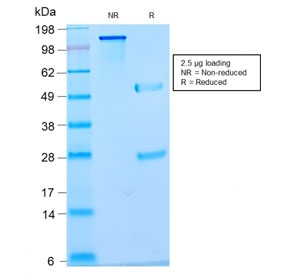 SDS-PAGE analysis of purified, BSA-free recombinant Nuclear Marker antibody (clone NM2984R) as confirmation of integrity and purity.