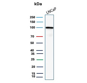 FOLH1 Antibody LNCaP WB. Western blot analysis of human LNCaP cell lysate using FOLH1 antibody. A strong band is detected at approximately 100 kDa, consistent with the predicted molecular weight of Folate hydrolase 1 / FOLH1, also known as Prostate-specific membrane antigen / PSMA. The observed signal is consistent with established FOLH1 expression in prostate-derived cell models and supports its role as a membrane-associated enzyme involved in folate metabolism and prostate cancer-associated signaling pathways.