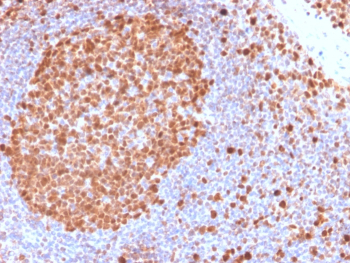 MCM7 Antibody Tonsil IHC. Immunohistochemical analysis of MCM7 / Minichromosome maintenance protein 7 in formalin-fixed, paraffin-embedded human tonsil tissue using MCM7 antibody clone MCM7/2832R. Intense nuclear staining is observed in germinal center cells, highlighting proliferative zones, while surrounding lymphocytes show reduced staining, consistent with differential proliferation status.