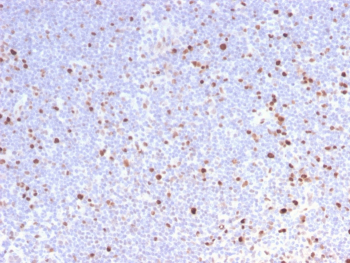 MCM7 Antibody Lymph Node IHC. Immunohistochemical analysis of MCM7 / Minichromosome maintenance protein 7 in formalin-fixed, paraffin-embedded human lymph node tissue using MCM7 antibody clone MCM7/2832R. Strong nuclear staining is observed in proliferating lymphoid cells, with scattered positive nuclei throughout the tissue consistent with active cell cycle progression.