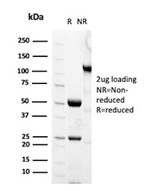 MCM7 Antibody SDS-PAGE (Reducing vs Non-Reducing). SDS-PAGE analysis of MCM7 antibody clone MCM7/2832R under reducing (R) and non-reducing (NR) conditions. Bands corresponding to antibody heavy and light chains are observed under reducing conditions, reflecting expected antibody structure.