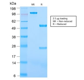 SDS-PAGE analysis of purified, BSA-free recombinant CD31 antibody (clone C31/2876R) as confirmation of integrity and purity.