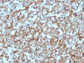 IHC testing of FFPE human pancreas with recombinant Spectrin beta III antibody (clone SPTBN2/3142R). Required HIER: boil tissue sections in 10mM citrate buffer, pH 6, for 10-20 min followed by cooling at RT for 20 min.