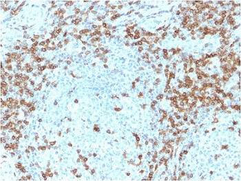 CD5 Antibody Clone CD5/2419. Immunohistochemistry analysis of CD5 antibody staining in FFPE human tonsil tissue using a HuProt validated specificity antibody. Strong membranous staining is observed in T lymphocytes within interfollicular regions, with dense labeling surrounding germinal centers while follicular B cell areas remain largely negative. The staining pattern highlights normal tonsillar architecture and supports highly selective detection of CD5-positive T cell populations, consistent with proteome-scale HuProt validation. Heat-induced epitope retrieval was performed in 10 mM citrate buffer, pH 6, for 10-20 minutes followed by cooling at room temperature prior to antibody incubation.