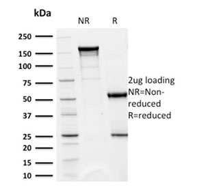 SDS-PAGE analysis of purified, BSA-free CD5 antibody (clone CD5/2418) as confirmation of integrity and purity.