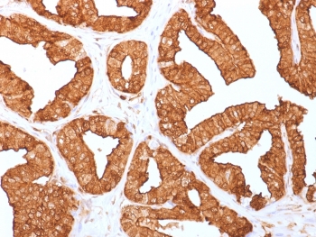 IHC staining of FFPE human prostate with Annexin A1 antibody (clone ANXA1/1671). HIER: boil tissue sections in pH6, 10mM citrate buffer, for 10-20 min and allow to cool before testing.