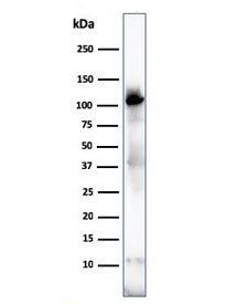 Western blot testing of human skeletal muscle lysate with Sarcomeric Alpha Actinin antibody (clone ACTN2/3292). Predicted molecular weigth ~103 kDa.