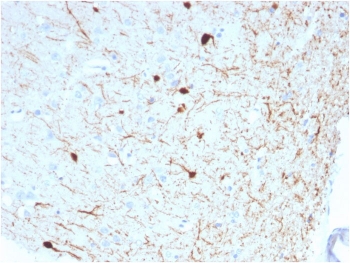 IHC testing of FFPE human cerebellum with Calbindin 2 antibody (clone CALB2/2786). HIER: boil tissue sections in pH 9 10mM Tris with 1mM EDTA for 10-20 min followed by cooling at RT for 20 min.