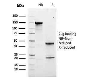 SDS-PAGE analysis of purified, BSA-free Calbindin 2 antibody (clone CALB2/2807) as confirmation of integrity and purity.