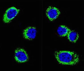 Immunofluorescent staining of human Jurkat cells with PD-L2 antibody (green, clone CDLA273-1) and DAPI nuclear stain (blue). HIER: steam section in pH6 citrate buffer for 20 min.