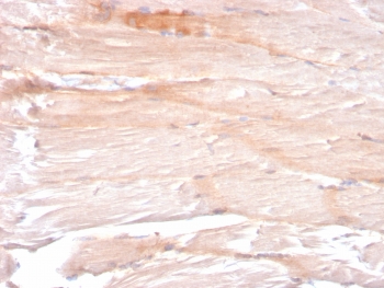Dystrophin Antibody Skeletal Muscle Fiber IHC. Immunohistochemistry analysis of FFPE skeletal muscle tissue using Dystrophin Antibody (clone DMD/3241) shows reduced and discontinuous membranous staining along individual muscle fibers, consistent with altered dystrophin localization at the sarcolemma. The fragmented staining pattern contrasts with the continuous membrane outline typically observed in normal muscle, supporting detection of dystrophin in a context of compromised muscle fiber integrity. Hematoxylin counterstain provides nuclear contrast and tissue architecture. HIER: boil FFPE tissue sections in pH 6 10 mM citrate buffer for 10-20 min and allow to cool before testing.