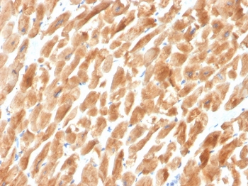 Dystrophin Antibody Human Cardiac Muscle IHC. Immunohistochemistry staining of FFPE cardiac muscle with Dystrophin antibody (clone DMD/3242). HIER: boil tissue sections in pH 9 10mM Tris with 1mM EDTA for 20 min and allow to cool before testing.