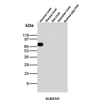 Albumin Antibody Human Dominant Signal WB. Western blot analysis of human, mouse, rat, hamster, and guinea pig liver tissue lysates using Albumin antibody detects a prominent band at approximately 65-70 kDa in human liver, consistent with the predicted molecular weight of Albumin (ALB), with minimal signal observed in other species under these conditions; detection was performed with clone ALB/2141.