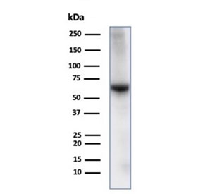 Albumin Antibody Human Liver WB. Western blot analysis of human liver tissue lysate using Albumin antibody detects a strong band at approximately 65-70 kDa, consistent with the predicted molecular weight of Albumin (ALB), a major liver-derived serum protein and marker of hepatocyte function; detection was performed with clone ALB/2141.