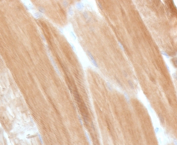 Dystrophin Antibody Muscle IHC. Immunohistochemistry staining of FFPE skeletal muscle with Dystrophin antibody (clone DSTN-1). HIER: boil tissue sections in pH 9 10mM Tris with 1mM EDTA for 10-20 min and allow to cool before testing.