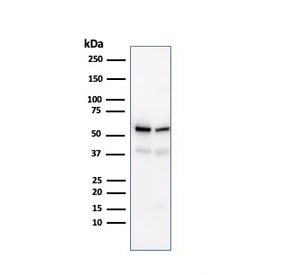 SERBP1 Antibody WB. Western blot analysis of human K562 and PC-3 cell lysates using SERBP1 Antibody detects bands migrating between approximately 45-60 kDa, consistent with the predicted molecular weight of SERBP1 and known variability in migration associated with post-translational modification and RNA-binding protein-associated electrophoretic behavior. This mRNA binding protein antibody highlights expression of SERBP1-associated post-transcriptional regulatory signaling pathways in hematologic and epithelial-derived tumor cell lines.