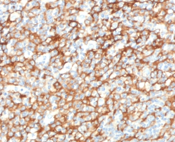 IHC staining of FFPE human tonsil tissue with CD73 antibody (clone CDLA73-1). HIER: boil tissue sections in pH9 10mM Tris with 1mM EDTA for 10-20 min and allow to cool before testing.