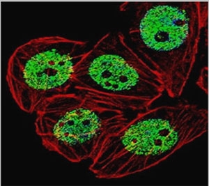 Immunofluorescence staining of human PFA-fixed MCF-7 cells with Estrogen Receptor alpha antibody (green, clone NR3Ga-4) and Phalloidin (red).