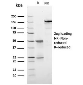 SDS-PAGE analysis of purified, BSA-free HER2 antibody (clone ERBB2/3257) as confirmation of integrity and purity.