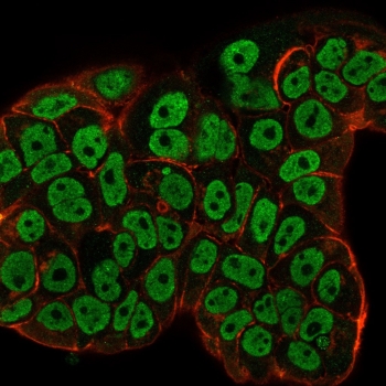 Estrogen Receptor alpha Antibody MCF7 Cell IF. Immunofluorescence analysis of Estrogen Receptor alpha antibody microarray validated clone ESR1/3557 in human MCF-7 cells. Formalin-fixed human MCF-7 breast carcinoma cells show strong nuclear green fluorescence using clone ESR1/3557, consistent with Estrogen Receptor alpha / ESR1 localization. Phalloidin (red) highlights actin filaments within the cytoskeleton. The nuclear staining pattern aligns with expected ER alpha distribution in hormone-responsive breast cancer cells.