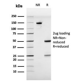 SDS-PAGE analysis of purified, BSA-free Estrogen Receptor alpha antibody (clone ESR1/3557) as confirmation of integrity and purity.