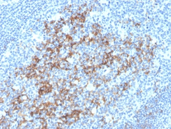 CD23 Antibody Tonsil IHC. Immunohistochemistry analysis of FFPE human tonsil tissue stained with CD23 antibody clone FCER2/3592. Distinct membranous and cytoplasmic HRP-DAB brown staining is observed in germinal center-associated B lymphocytes and follicular dendritic cell networks, consistent with the established expression pattern of Low-affinity immunoglobulin epsilon Fc receptor / FCER2/CD23 in reactive lymphoid follicles. The staining pattern highlights follicular architecture with strong positivity in B-cell-rich germinal center regions and comparatively minimal staining in surrounding interfollicular T-cell areas. Hematoxylin counterstain highlights nuclei in blue. HIER: boil tissue sections in pH6 citrate buffer for 10-20 min followed by cooling before antibody incubation.
