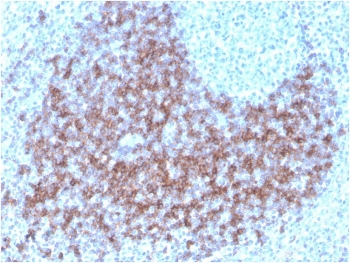Immunohistochemistry of CD23 Antibody Biotin Conjugate in human tonsil. FFPE human tonsil tissue was stained with biotin-labeled CD23 antibody (clone FCER2/3592). Prominent membranous HRP-DAB brown staining is observed in B lymphocytes within germinal centers and mantle zone regions, consistent with established CD23 expression on mature follicular B cells. The staining pattern highlights follicular architecture, with dense labeling in B cell rich areas and minimal staining in adjacent T cell predominant interfollicular zones. Heat induced epitope retrieval was performed by boiling tissue sections in pH 9 Tris-EDTA buffer for 20 minutes followed by cooling prior to antibody incubation. The biotin conjugate format allows detection using streptavidin based amplification systems.