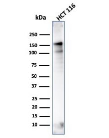 MSH6 antibody western blot testing of human HCT116 lysate with clone MSH6/3086. Expected molecular weight: 120-160 kDa depending on phosphorylation level.