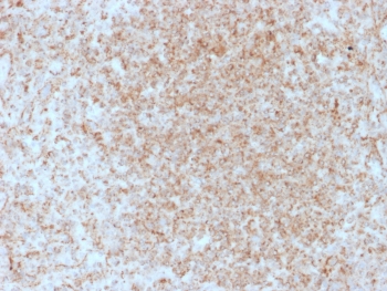 IHC staining of FFPE human spleen with CD137/4-1BB antibody (clone 4-1BB/3201). HIER: boil tissue sections in pH9 10mM Tris with 1mM EDTA for 10-20 min and allow to cool before testing.