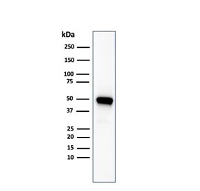 Western blot testing of human kidney lysate with CD137/4-1BB antibody. Expected molecular weight: ~30 kDa monomer and 55-60 kDa dimer. Higher molecular weights may be observed due to glycosylation.