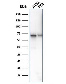 Western blot testing of human 1) A431 and 2) PC-3 cell lysate with CD73 antibody (clone NT5E/2646). Predicted molecular weight: 60-70 kDa.
