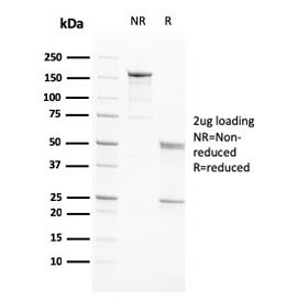 SDS-PAGE analysis of purified, BSA-free PAPPA antibody (clone PAPPA/2717) as confirmation of integrity and purity.