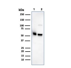 Western blot testing of human 1) K562 and 2) PC-3 cell lysate with SERBP1 antibody. Predicted molecular weight ~45 kDa but observed at 45-60 kDa.