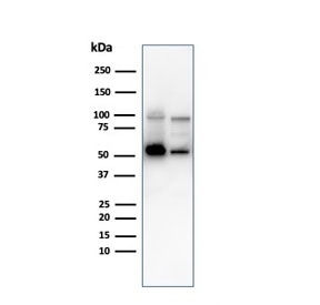 Western blot testing of human 1) K562 and 2) PC-3 cell lysate with SERBP1 antibody. Predicted molecular weight ~45 kDa but observed at 45-60 kDa.
