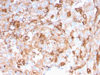SERBP1 Antibody Kidney IHC. Immunohistochemistry testing of FFPE human kidney with SERBP1 antibody (clone SERBP1/3496). Required HIER: boil tissue sections in pH6, 10mM citrate buffer, for 10-20 min followed by cooling at RT for 20 min.