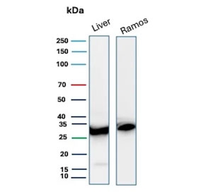 Western blot testing of human liver and Ramos cell lysate with Prohibitin antibody (clone PHB/3225). Expected molecular weight ~30 kDa.
