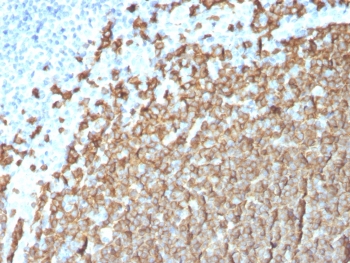 Immunohistochemistry analysis of CD20 Antibody for IHC in human tonsil tissue. FFPE human tonsil demonstrates strong membranous HRP-DAB brown staining in B lymphocytes within germinal centers and follicular regions, consistent with CD20/MS4A1 surface expression, while interfollicular areas show comparatively reduced staining. Antigen retrieval was performed by boiling tissue sections in pH 6 10mM citrate buffer for 10-20 minutes followed by cooling prior to incubation with CD20 antibody (clone MS4A1/3411).