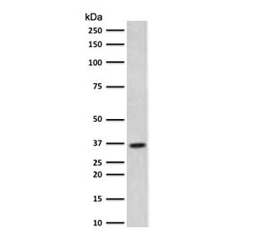 Western blot testing of human HeLa cell lysate with Thymidylate Synthase antibody (clone TYSY9-2). Predicted molecular weight ~36 kDa.