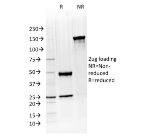 SDS-PAGE analysis of purified, BSA-free ATG5 antibody (clone ATG5/2492) as confirmation of integrity and purity.