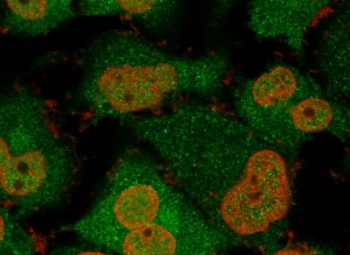 Immunofluorescent staining of permeabilized human T98G cells with recombinant UchL1 antibody cocktail (green, clone rUBCE-L1) and Nucspot (red).