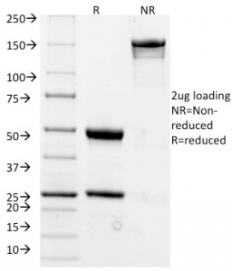 SDS-PAGE analysis of purified, BSA-free CD20 antibody (clone L26) as confirmation of integrity and purity.