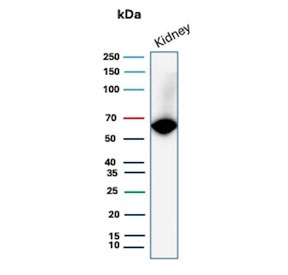 Western blot testing of human kidney tissue lysate with Occludin antibody. Predicted molecular weight ~59 kDa.